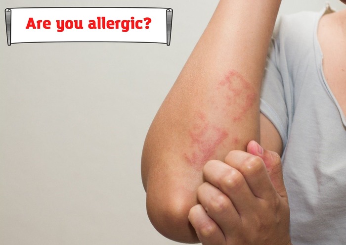 What if you are allergic?